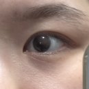 제일안과의원 | 동탄 퍼스트 안과의원 렌즈삽입술 후기1 👀⭐️(20년 넘은 안경인생의 선택)