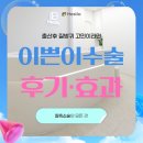 (개인)최민석 | 이쁜이수술후기 효과, 출산후 질방귀 고민이라면?