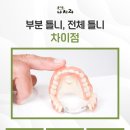 북면치과의원 | 창원북면치과 부분 틀니, 전체 틀니 무엇이 다를까요?