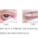 서광메디칼 이미지