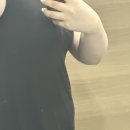 구내식당 다올팜 세종점 | 세종지방분해주사 복부제로팻 1회차 , 다이어트 찐 후기