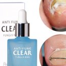 페디베네 이미지