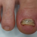 레푸스 감삼점&에이레네 이미지