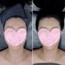 아델라인뷰티 | 테라피 관리를 아시나요? 검단 피부관리로 유명한 <아델라인 뷰티&바디테라피>에서 신세계를 경험 한 날