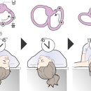 이석증은 어떤 병? 이미지