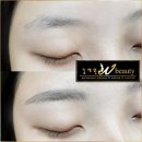 김채원W뷰티 이미지