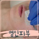 영인 | 마곡에스테틱 방화동 영인피부 솔직후기