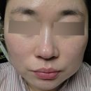 듀얼엠 | 내돈내산 듀얼테트라 45일차 사용후기