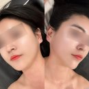 리하 | 연산동 피부관리 리하에스테틱 솔직후기