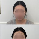 광주 도연아카데미 홈쎄라 리프팅 관리 후기, 탄력 고민으로 방문했어요