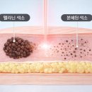 호평로46번길1L | 호평동슈링크 리프팅 효과와 시술 주기, 추천 대상