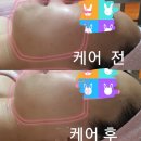 에스테라피 이미지