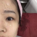 [부산] 연산동피부관리 ‘H뷰티엠’ 세멘시트관리 후기