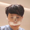 명작치과의원 | 부산 비중격만곡증 비염수술 명작이비인후과 수술 후기