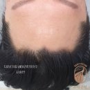 분당두피문신 고민 끝! 두피공방에서 자신감을 되찾은 솔직 후기