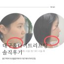 올도 | 대구 올타이트리프팅 솔직후기