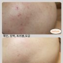 라벨르피부관리실 | 울산 피부관리 라벨르 에스테틱, 피부관리실 선택 기준이 달라지고 있습니다.