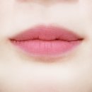 미케이의원 | 강남 입술필러 잘하는곳 미케이 후기