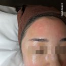 청주 오송 풀페이스 왁싱 / 블리스왁싱 오송점