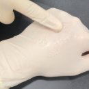 오빗의원 | 필러 종류와 입술필러 후기들을 모아봤습니다.