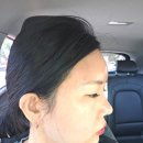 부평역(인천1호선) | 인천필러 부평피부과 이마필러 6cc 통증 유지기간 전후 후기 내돈내산 후기