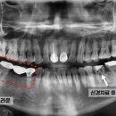 연세내일치과의원 이미지