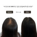 블랙인스칼프 이미지