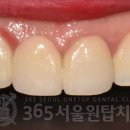 원탑 치과기공소 이미지