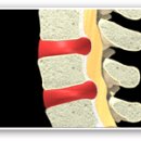 척추건강 강좌 이미지