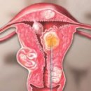 루쎄여성의원 이미지