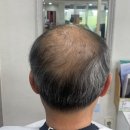 모앤모헤어 | 흰머리 데일리스타일 맞춤가발 맛집 모앤모가모센터!