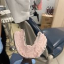 캐나다 치과보조사 과정 Certified Dental Assisting (CDA) Course - 네 달차 후기