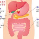 명치 누르면 통증 답답함 아플때 이유 이미지