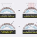 강남조은눈안과의원 이미지