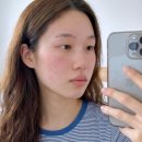 고려약국 | 약국재생크림 접촉성 피부염 사용후기