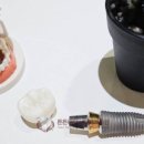 튼튼내이사랑치과의원 이미지