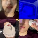 41190-01-07-202 | 잠실송파 여드름 피부 관리 압출맛집 솔에스테틱 송파직영점 솔직 후기