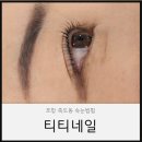 포항제일약국 | 포항죽도동속눈썹펌 강남출신 17년경력 티티네일 후기