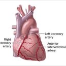 심혈관 질환의 종류와 증상|☞건강정보 이미지