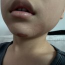 동아약국 | 동아제약 디판테놀 약국 가격, 아이 얼굴 D 판테놀 연고 후기