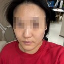 영인케어 이미지