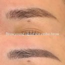 우영 | 브로우영 눈썹 시술 후기