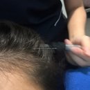 붕붕카닥터부분정비 | 광명 철산 닥터포헤어 두피, 탈모 관리센터