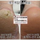 레푸스 이미지