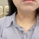 갑상선 결절 혹 세침검사 부산 삼성내과 방문 후기