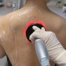 디오스컴퍼니 | 고주파다이어트 초음파 뱃살관리하기 라디오메타보플러스 한달사용후기