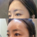 누브의원 이미지