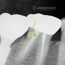 소망치과기공소 네이버블로그