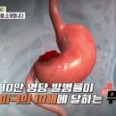 [명의 명답, 위암] 위암 유발 주범들에 대해 두 명의와 함께 자세히 알아본다 이미지