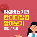 여자 질염 종류 증상 원인 치료 약 냄새 냉 (칸디다 / 위축성 / 트리코모나스 / 세균성 ) 정리함 이미지